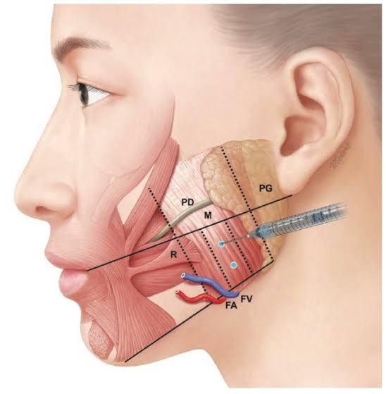 anatomy โบทอกกราม