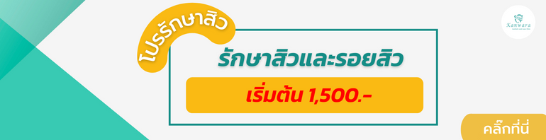 ้โปรรักษาสิว รอยสิว