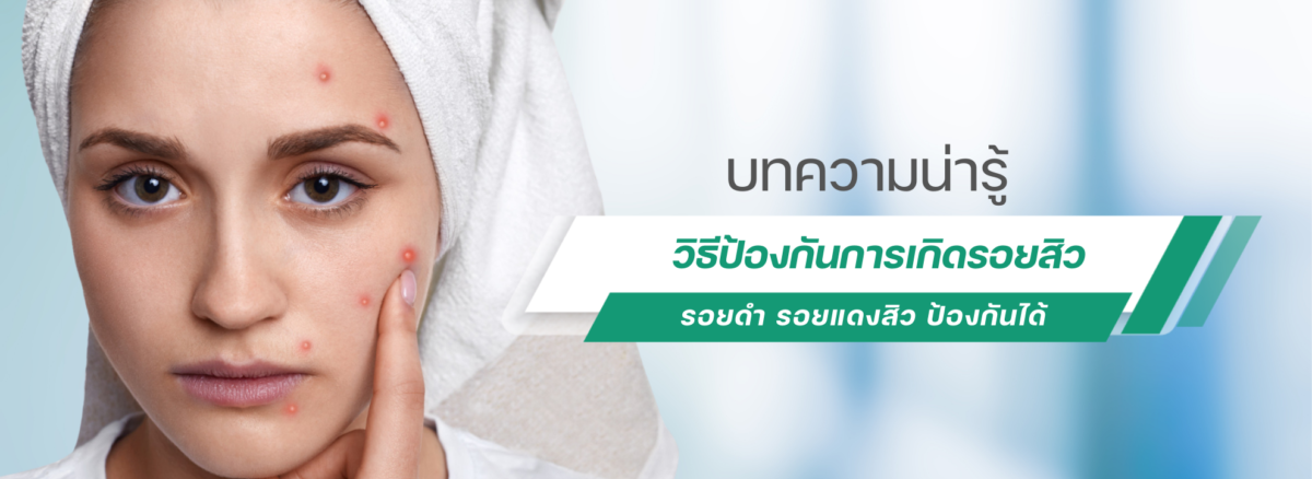 วิธีป้องกันการเกิดรอยสิว