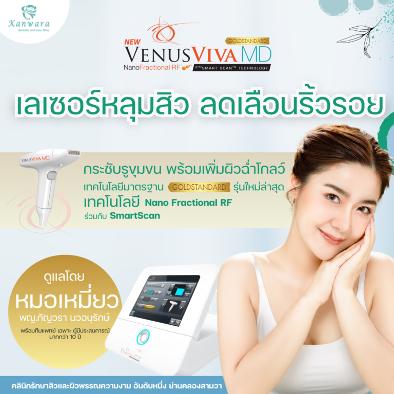 VenusViva MD เลเซอร์หลุมสิว