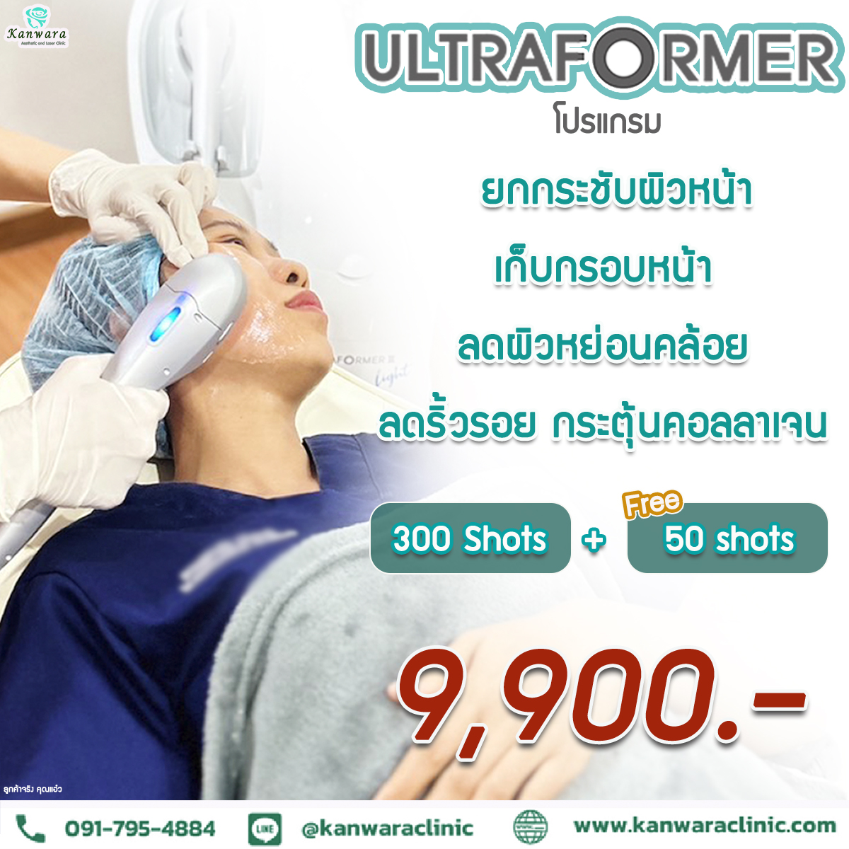 ultraformer 300 จุด ฟรี 50 ราคา 9900
