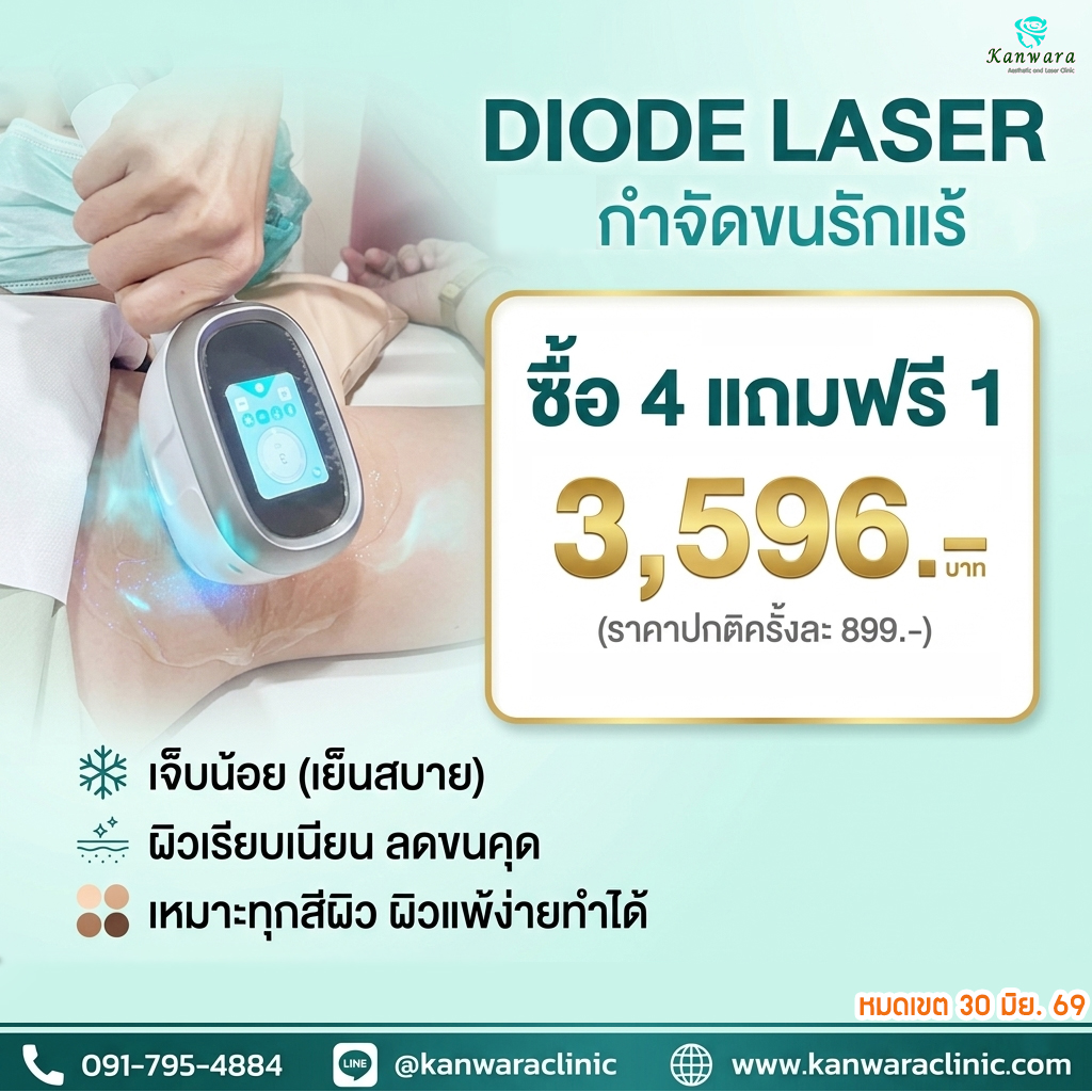 กำจัดขน รักแร้ 4 แถม 1